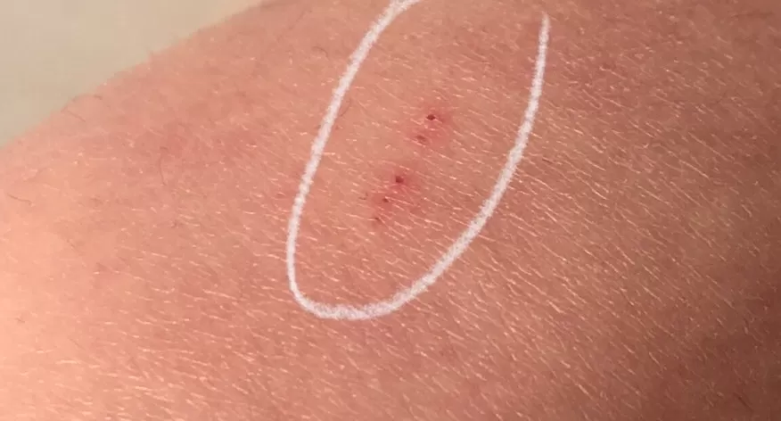 旅游推荐一人游：初次出国独行韩国后竟染上皮💢肤病……