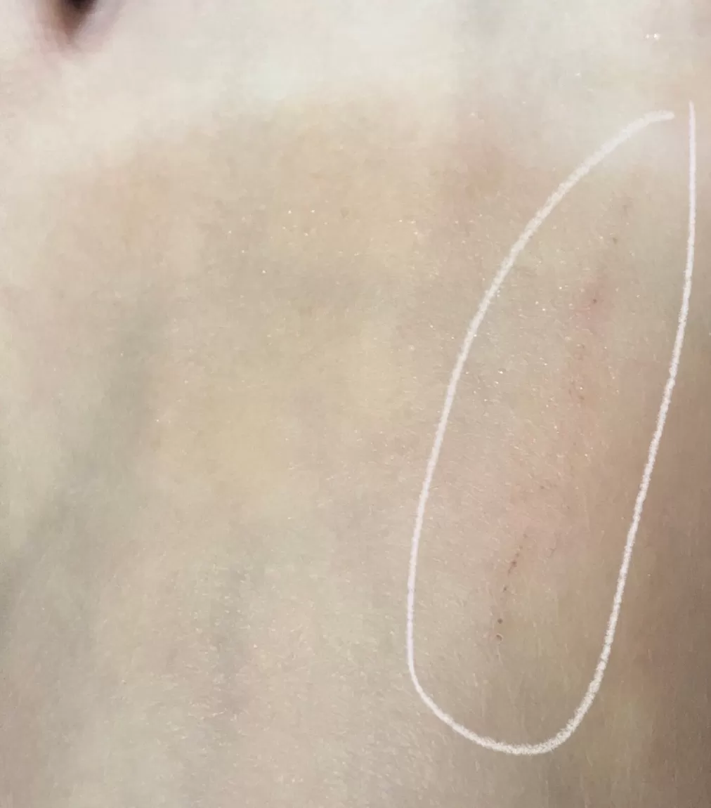 旅游推荐一人游：初次出国独行韩国后竟染上皮💢肤病……