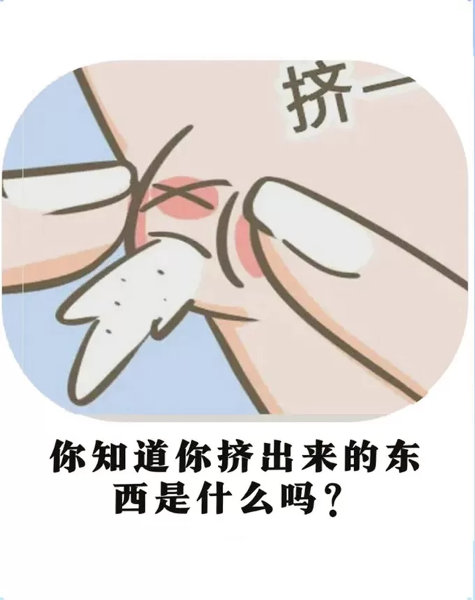 💗进来自测一下吧!你的痘.痘挤出来是什么?