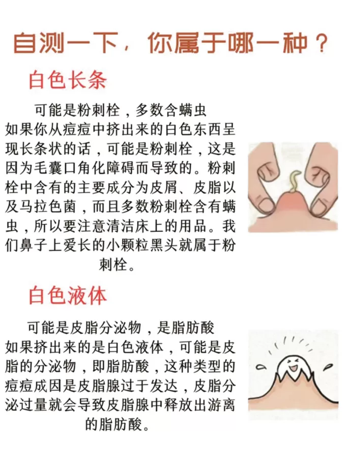 💗进来自测一下吧!你的痘.痘挤出来是什么?