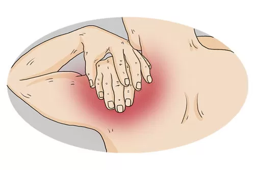 🥉肩膀进寒气引起瘀堵造成肩周炎